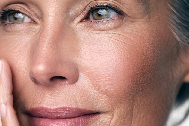Sculptra treatments at SkynBar Atlanta