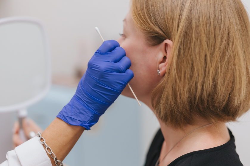 Sculptra and filler treatments at SkynBar Atlanta